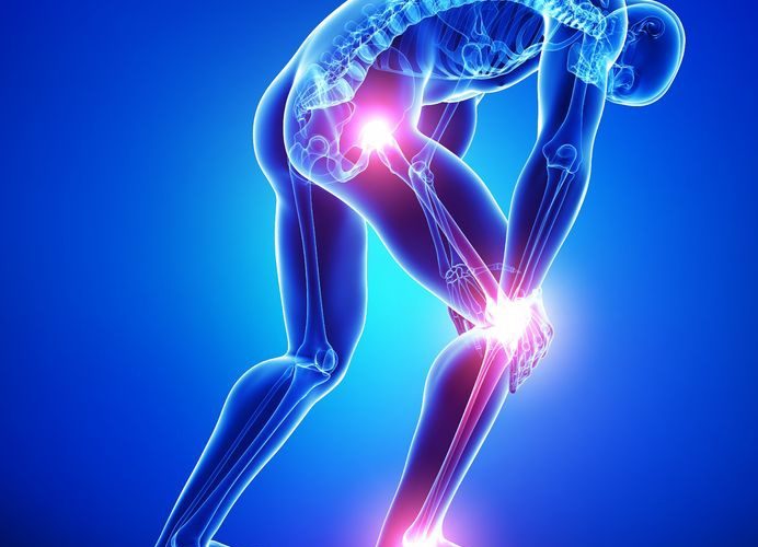 ألم العصب الوركي / عرق النسا / Sciatica